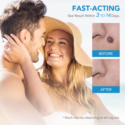 Skin Tag Removal Pen
