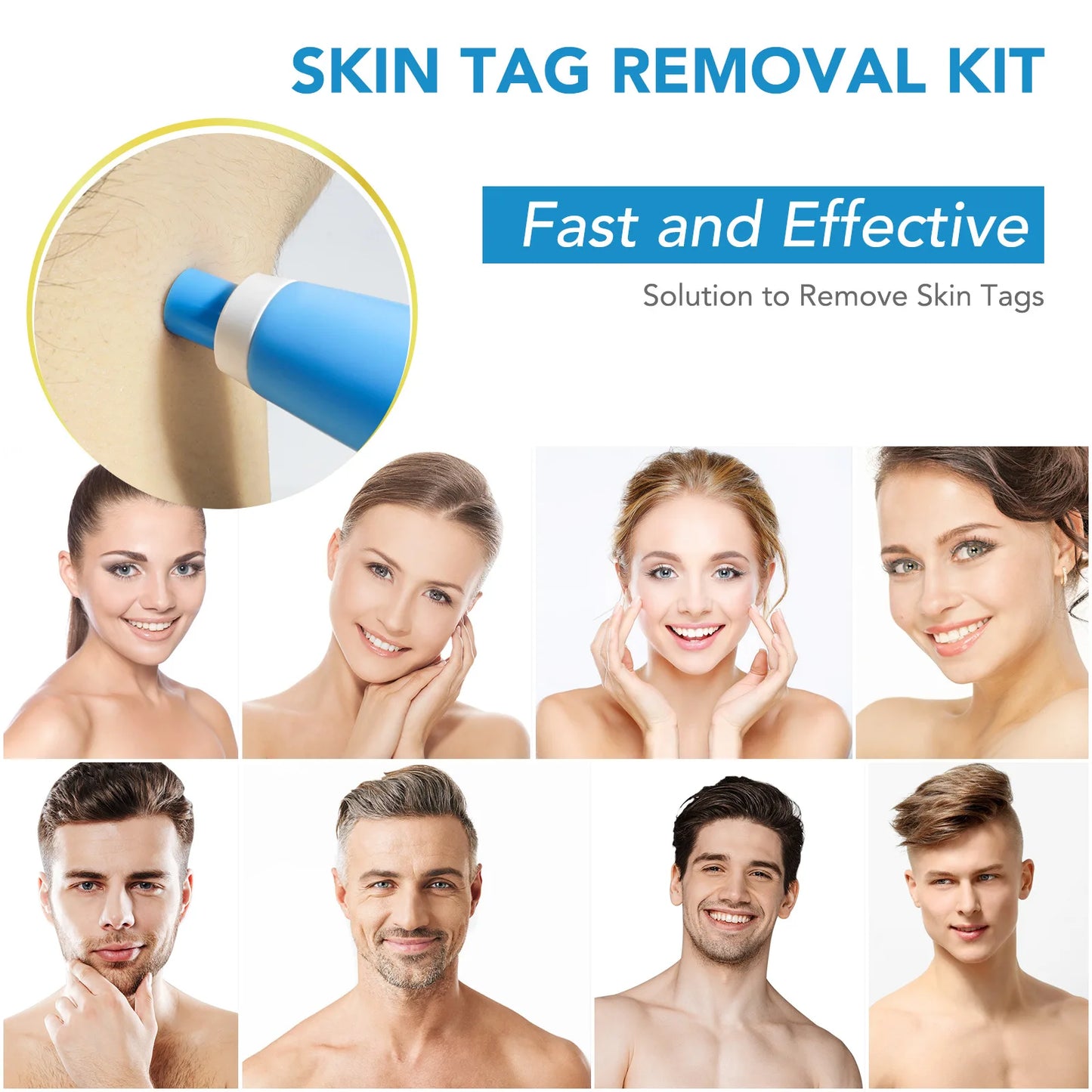 Skin Tag Removal Pen