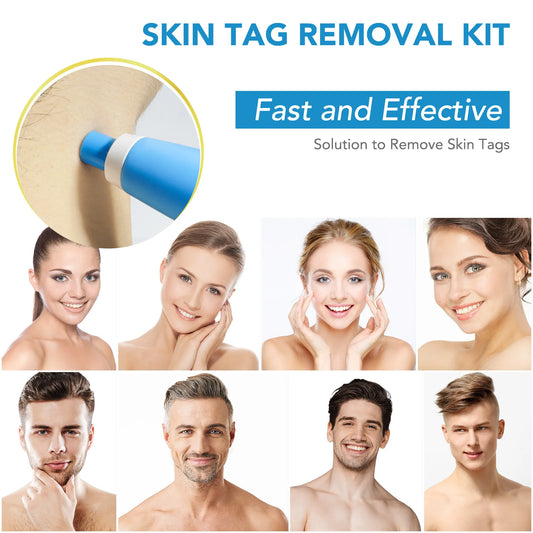 Skin Tag Removal Pen