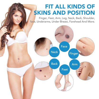 Skin Tag Removal Pen